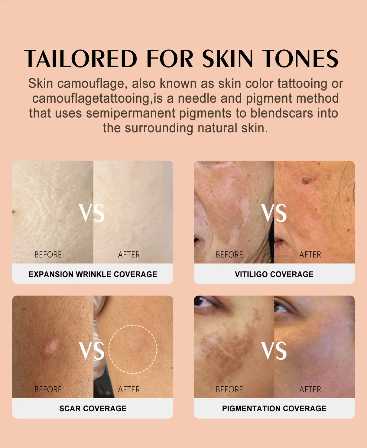 YD Professional 10ML Camouflage Pigment Semi Permanent Makeup Tattoo Ink for Scar Cover Stretch Marks Vitiligo Restore Skin Tone