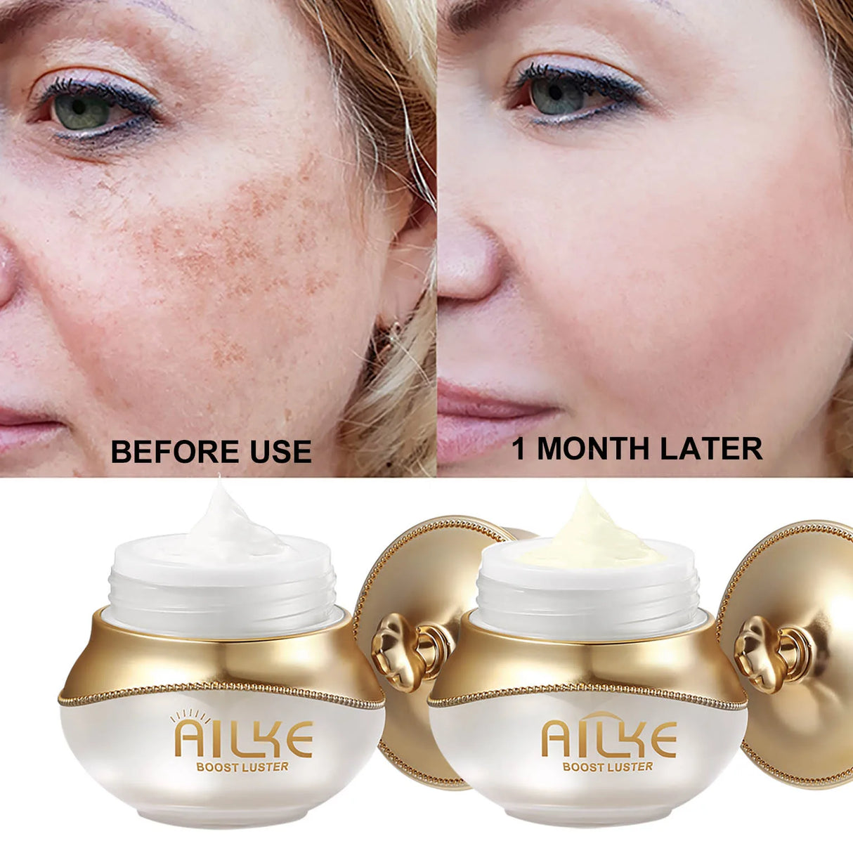 AILKE Women Whitening Facial Skin Care Set, Dark Spots Remover, Anti Wrinkles, Even Skin Tone, for All Skin Types Kit