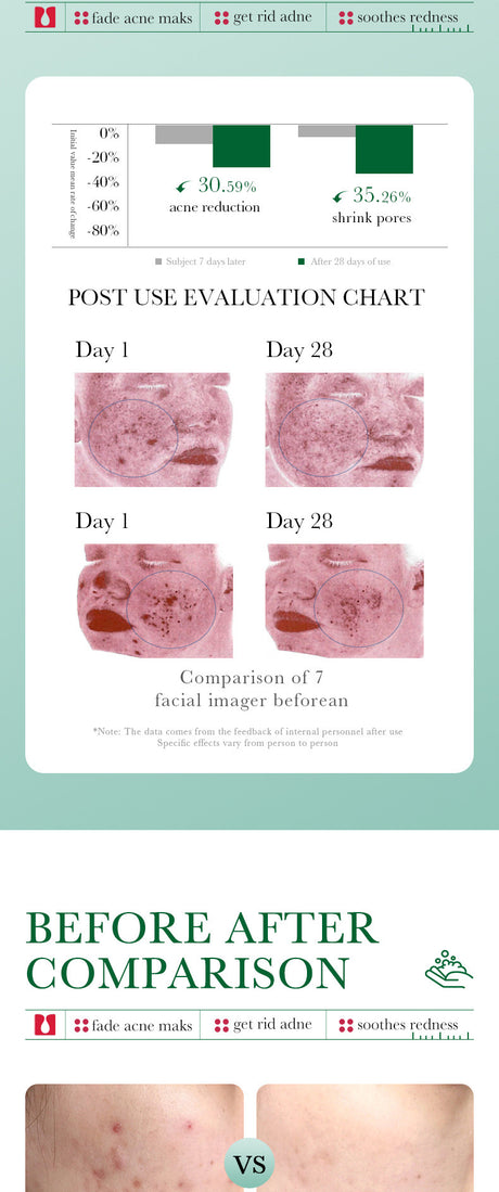 BIOAQUA Salicylic Acid Facial Cleanser Acne Treatment Moisturizing Oil Control Skincare Face Wash Foam Face Cleanser Skin Care