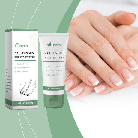 Nail Fungal Treatment Ointment Anti Infection Paronychia Onychomycosis Soft Hand Feet Toenail Repair Damaged Health Care Cream