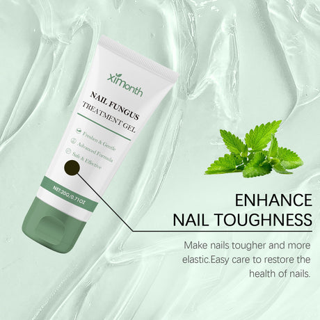 Nail Fungal Treatment Ointment Anti Infection Paronychia Onychomycosis Soft Hand Feet Toenail Repair Damaged Health Care Cream
