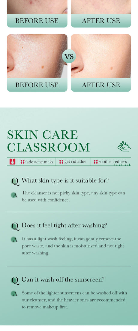 BIOAQUA Salicylic Acid Facial Cleanser Acne Treatment Moisturizing Oil Control Skincare Face Wash Foam Face Cleanser Skin Care