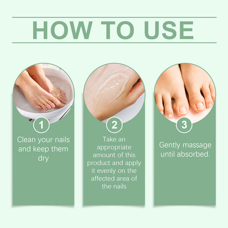 Nail Fungal Treatment Ointment Anti Infection Paronychia Onychomycosis Soft Hand Feet Toenail Repair Damaged Health Care Cream
