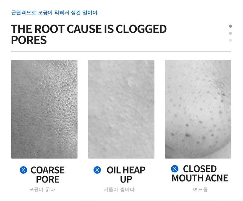 Salicylic Acid Pore Shrinking Cream Quick Elimination Large Pores Remove Blackehead Tighten Face Smooth Skin Korean Care Product