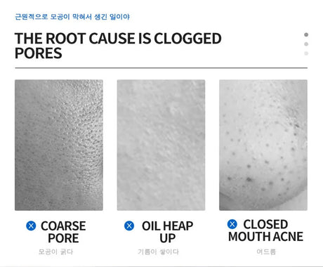 Salicylic Acid Pore Shrinking Cream Quick Elimination Large Pores Remove Blackehead Tighten Face Smooth Skin Korean Care Product