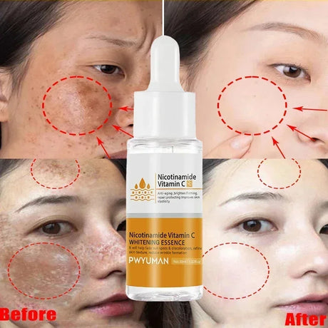 Powerful Dark Spots Remover Whitening Serum Face Freckle Melanin Correcting Anti Pigmentation Brighten Skin Beauty Care Products