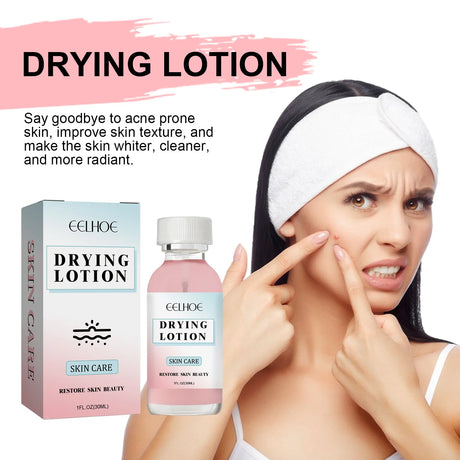 Salicylic Acid Facial Moisturizing Lotion Shrink Pores Nourishing Damaged Skin Treatment Acne Remove Spot Whitening Face Essence