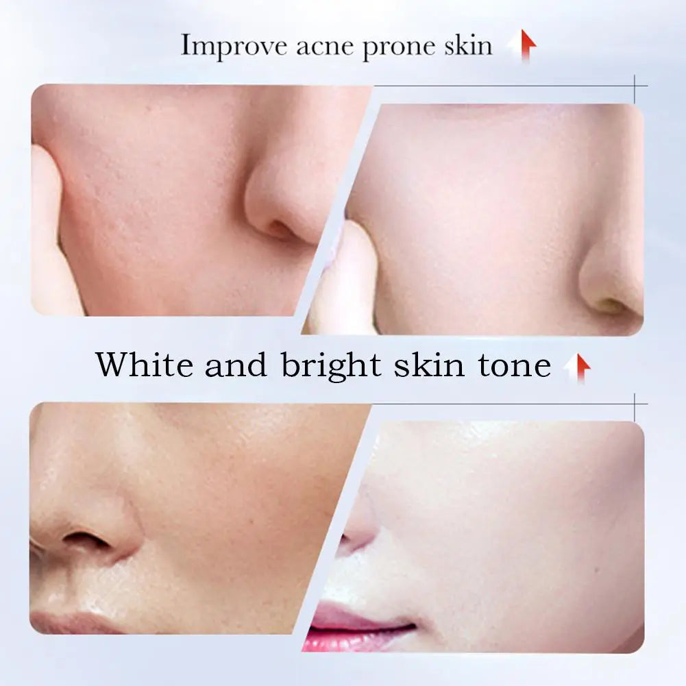 SADDER Kojic Acid Face Cream for Dark Spots Freckles Skin Care with Vitamin C, Whitening Treatment, Overnight Repair Moisturizer