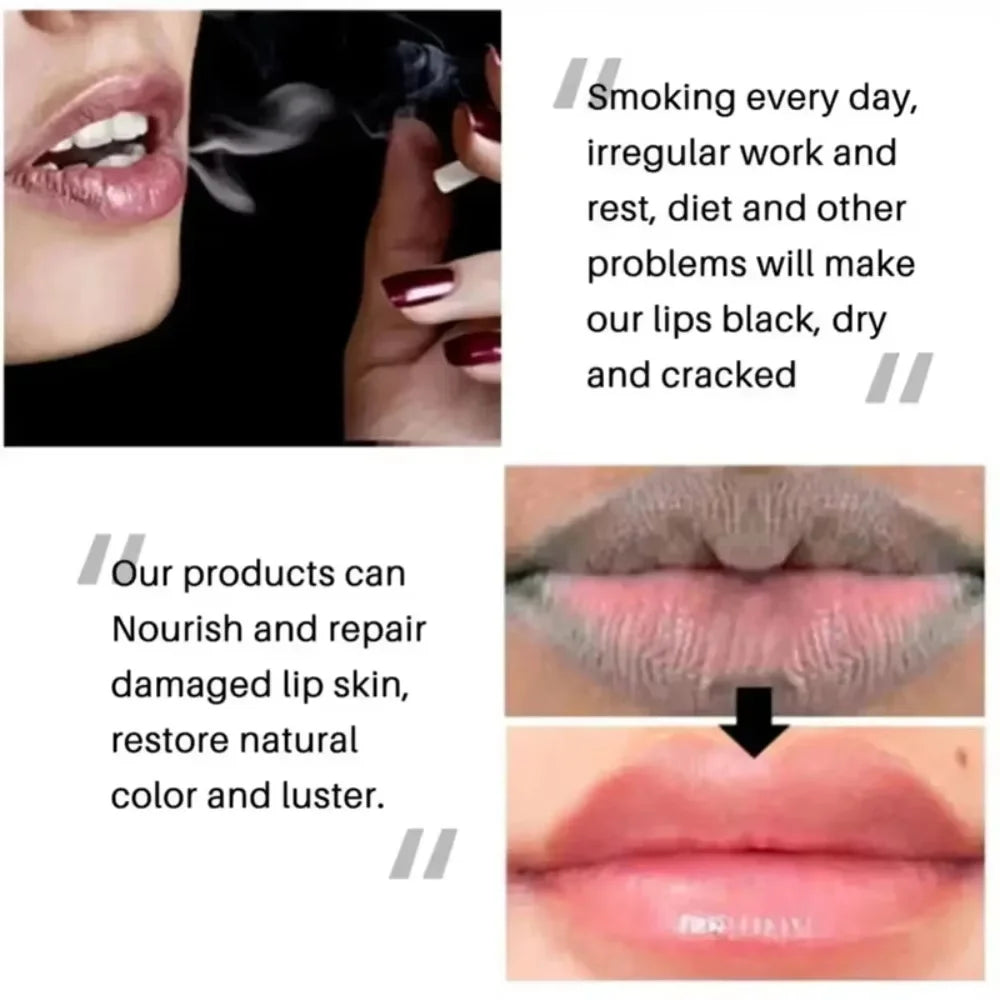 Remove Dark Lip Balm Fast Lightening Pink Lip Exfoliating Fade Lip Line Dead Skin Moisturizer Korean Care Products Beauty Health