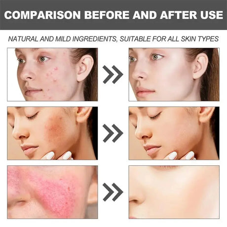 B5 Repair Cream Moisturizing Hydrating Effectively Solves Dry Chapped And Red Skin Nourishes Improve Repair Sunscreen Cream