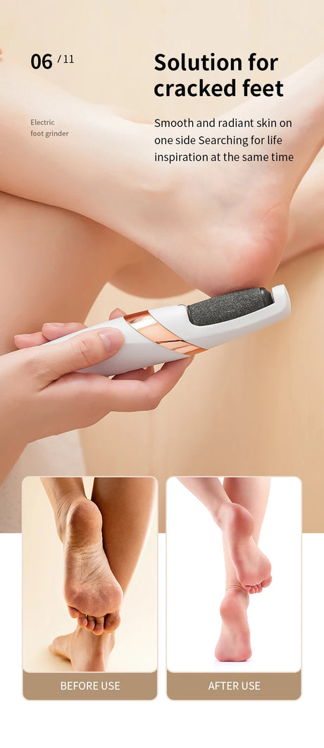 HOMEFISH Electric Foot Grinder Automatic Foot Callus Rubbing Pedicure Dead Skin Callus Remover for Foot Beauty Machine