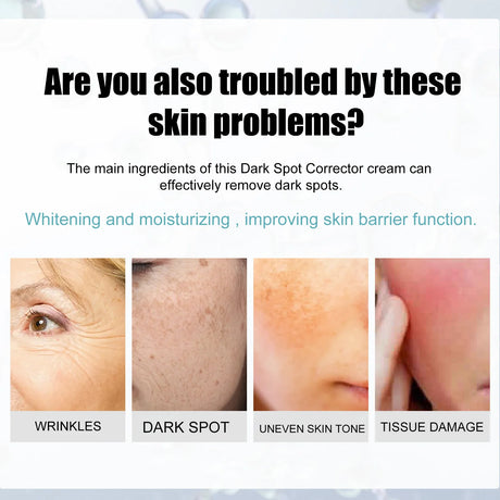 Freckle Whitening Cream Nicotinamide Fade Dark Spot Blemish Acne Mark Brightening Lightening Pigmentation Correction Cream