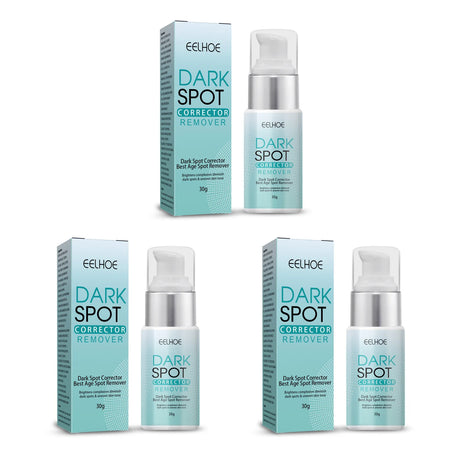 Freckle Whitening Cream Nicotinamide Fade Dark Spot Blemish Acne Mark Brightening Lightening Pigmentation Correction Cream