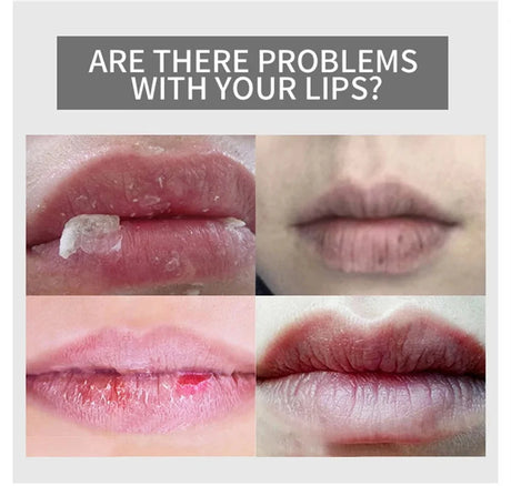 Korea Lips Care Mask Reduce Lip Wrinkles Remove Dead Skin Moisturizing Sleep Lip Balm Long-lasting Nourishing Lip Care Product