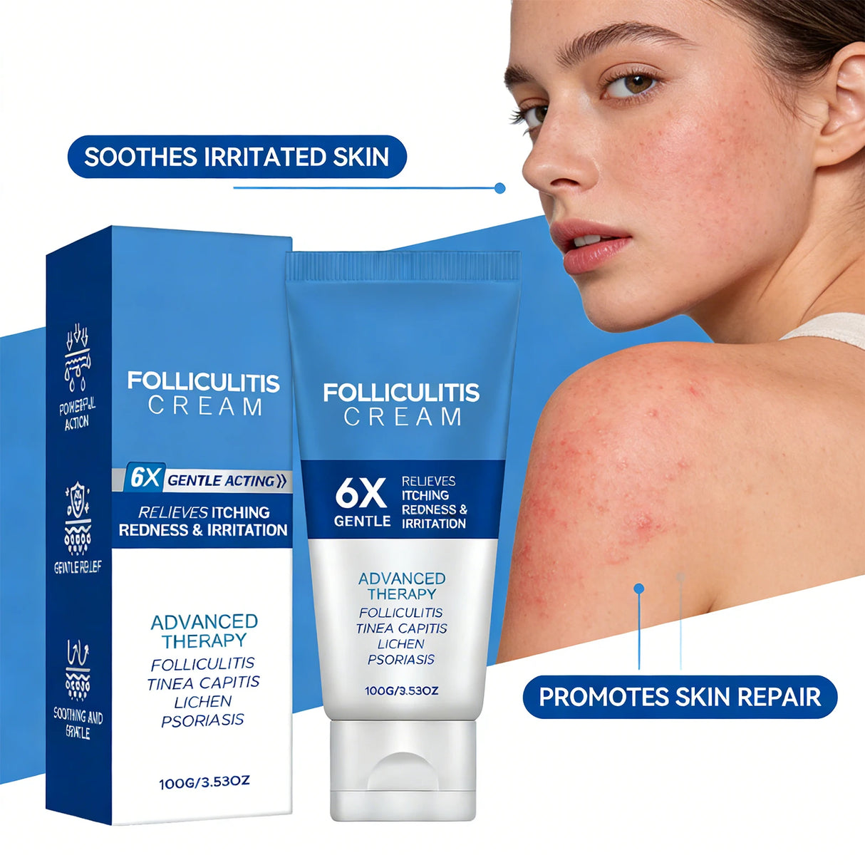 Folliculitis Cream Reduce Redness Relieve Itching Soothing Stimulating Herbal Gentle Smoothing Nourishing Care Cream