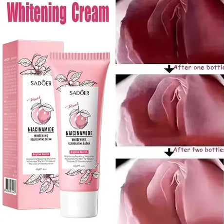 Niacinamide Brighten Body Cream Dark Skin Armpit Thigh Inner Joint Fade Intimate Area Underarm Private Part Lotion Body Care