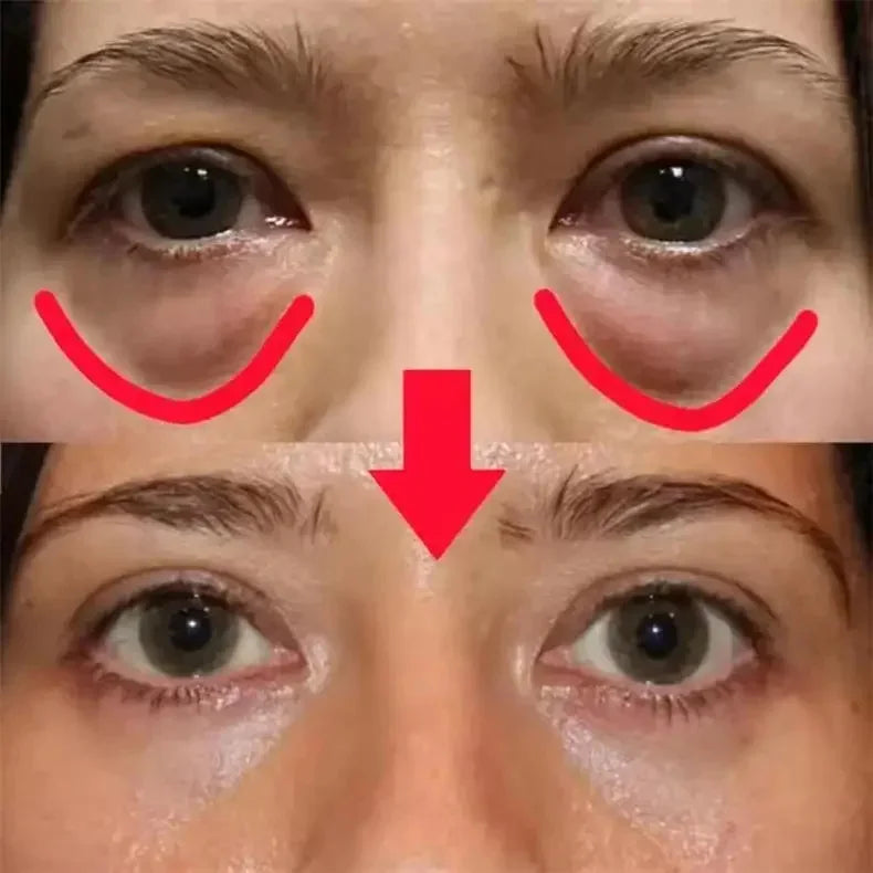 Caviar Eye Bag Removal Cream Hyaluronic Acid Anti-Wrinkle Firming Skin Fade Fine Lines Anti Dark Circle Puffiness Eye Care 20g