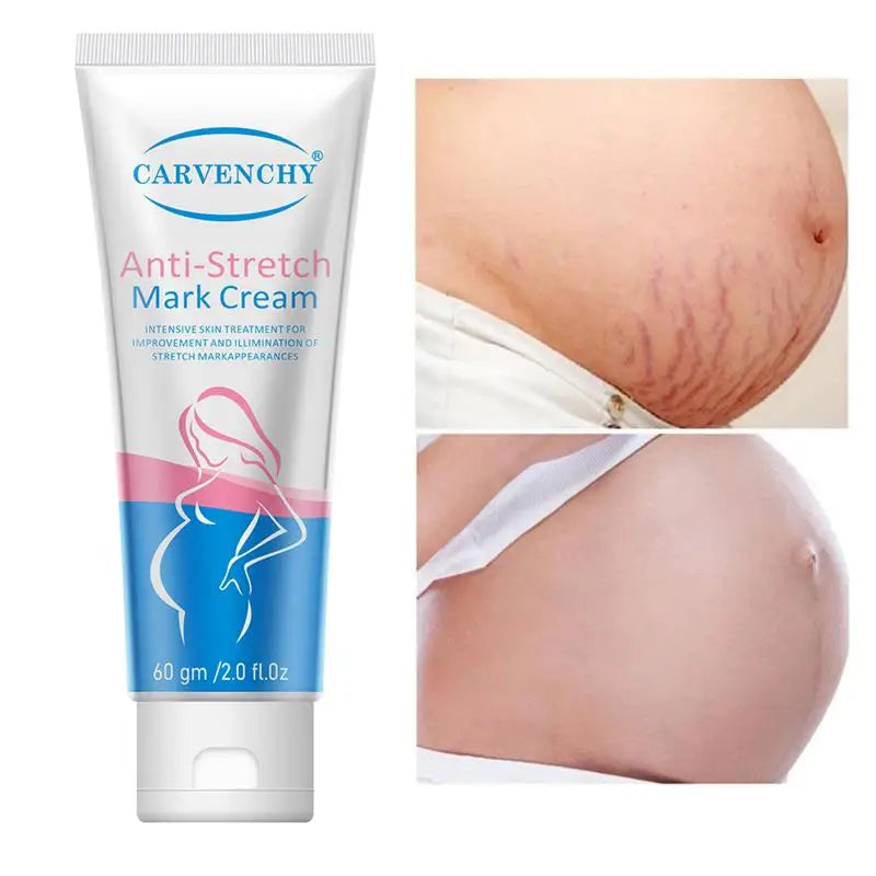 Snail Removes Stretch Mark Cream To Remove Postpartum Obesity Pregnant Women Repair Anti-Aging Anti-Winkles Firming Body Cream