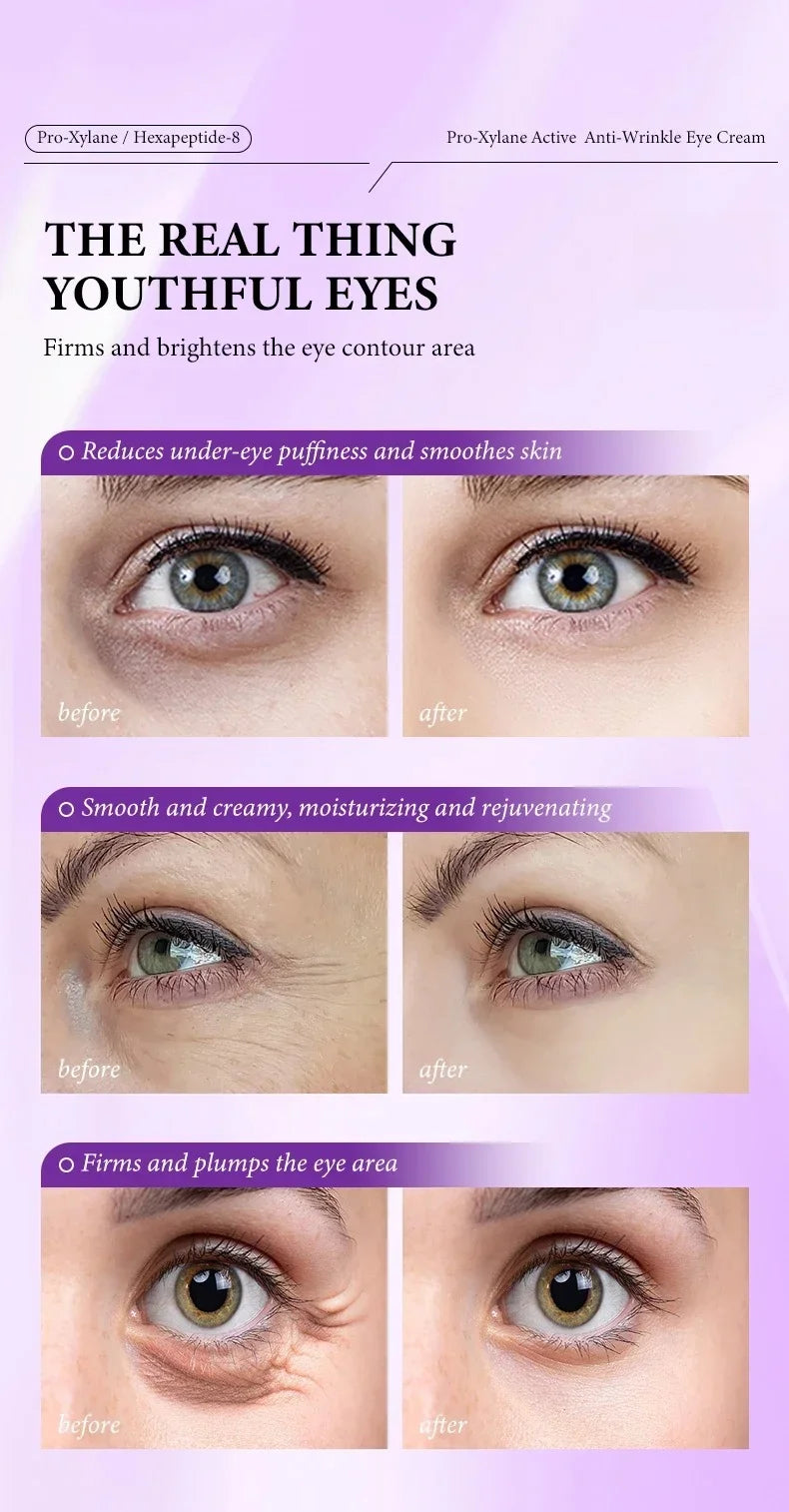 Instant Eye Bag Removal Cream Retinol Anti-Wrinkle Firming Skin Fade Fine Lines Anti Dark Circle Puffiness Brighten Eye Skincare