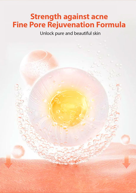 Herbal Acne Treatment Cream Anti Acne Face Cream Pimple Removal Spots Oil Control Shrink Pores Moisturizing Skin Care Cream