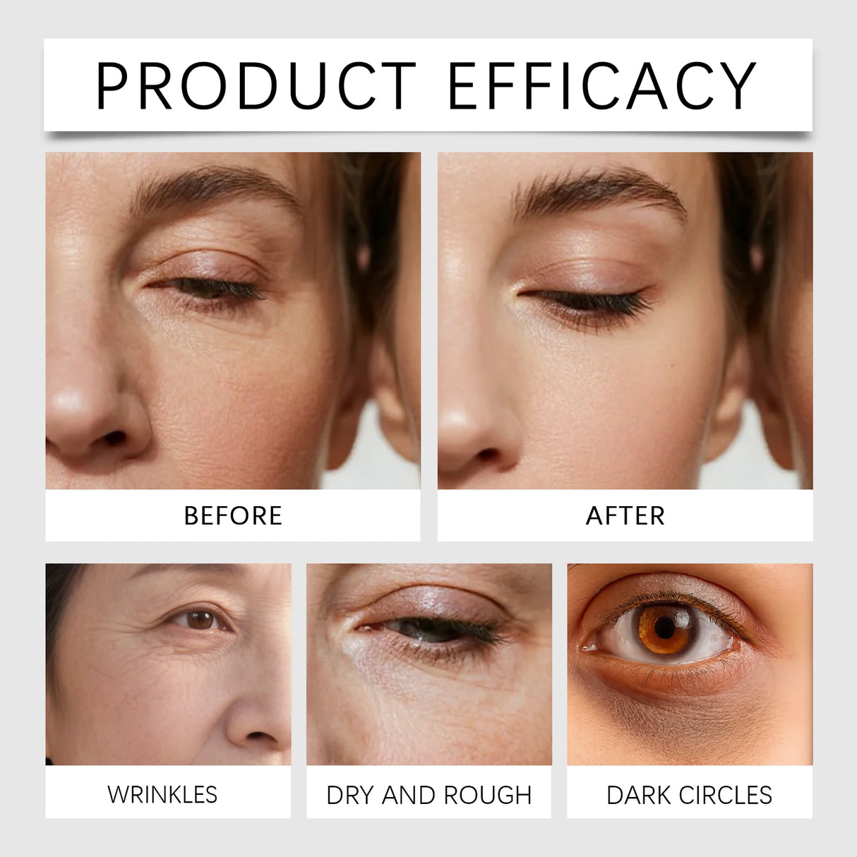 Eye-Lift Calcium Patches Instant Volume Boost & Brightening,Refreshing Hydrogel Mask for Tired Eye,Vegan & Cruelty-Free Skincare