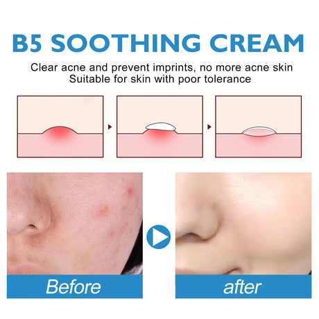 B5 Repair Cream Moisturizing Hydrating Soothing Dry Chapped Redness Skin Nourishes Hydrating Barrier Support Beauty Face Cream