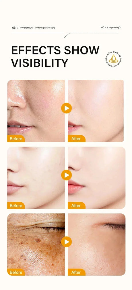 Dark Spots Remover Whitening Face Set Freckle Melanin Correcting Reduce Fine Lines Brighten Essence Korean Beauty Skin Care 