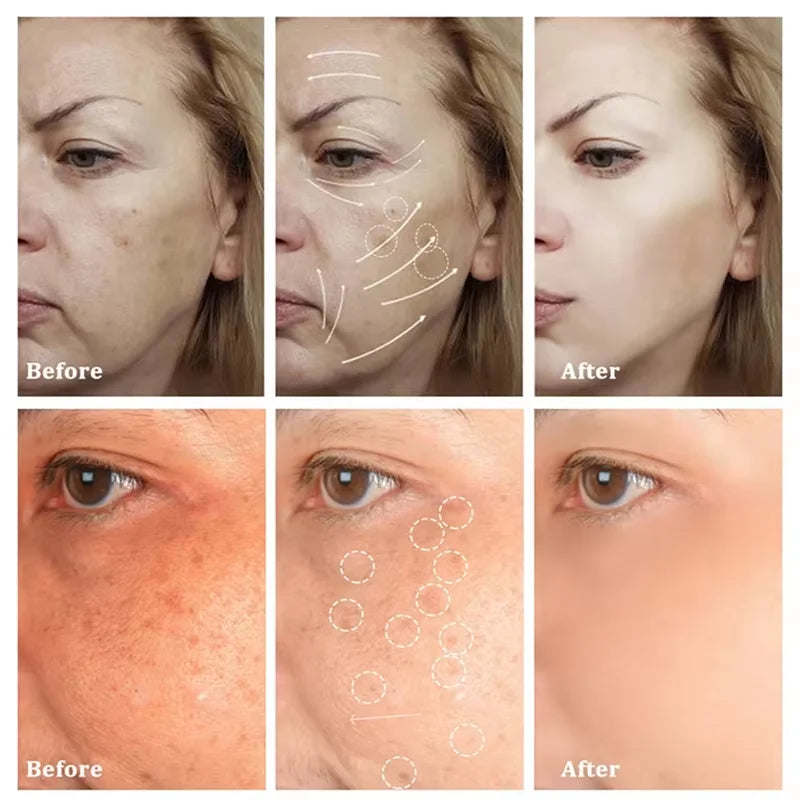 Powerful Dark Spots Remover Whitening Serum Face Freckle Melanin Correcting Anti Pigmentation Brighten Skin Beauty Care Products