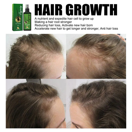 Hair Care Spray Ginger Massage Scalp Improve Dry Damaged Serum Smooth Nourish Repair Roots Anti Hair Loss Essence For Men Women