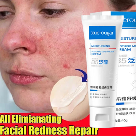 B5 Repair Facial Redness Cream Instant Spider Vein Remove Sensitive Skin Sooth Anti Redness Rosacea Treat Lotion Korean Cosmetic