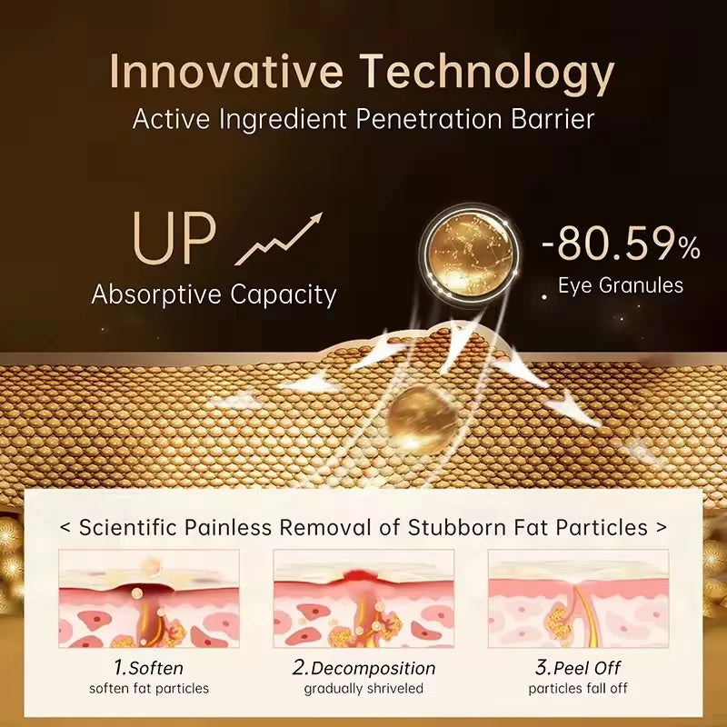 Remove Eye Fat Particles Serum Milia Treatment Products Anti Puffiness Anti Inflammatory Repair Skin Barrier Korean Skin Care