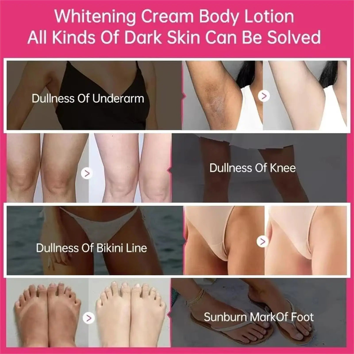 Body Whitening Cream Private Parts Underarm Bleaching Serum Whiten Butt Knee Brighten Inner Thigh Intimate Dark Remove Melanin