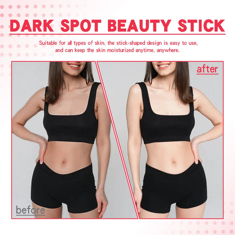 Lightening Body Cream Remove Dark Spots Melanin Bleaching Elbow Armpit Leg Knee Hips Thigh Moisturizing Whitening Underarm Stick