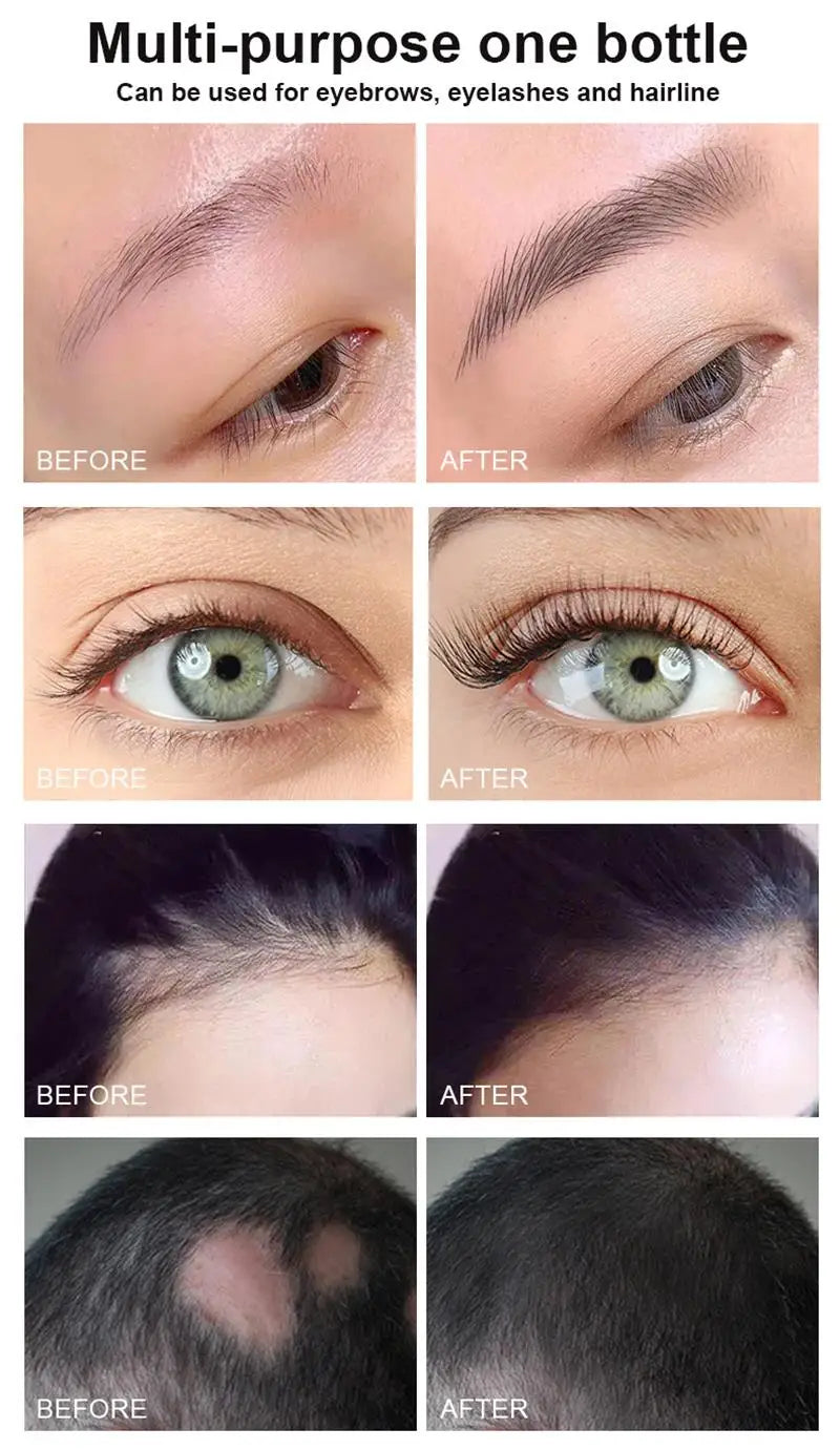 Fast Eyebrow Growth Serum Eyelash Hair Growth Anti Hairs Loss Product Prevent Baldness Fuller Thicker Lengthening Eyebrow Makeup