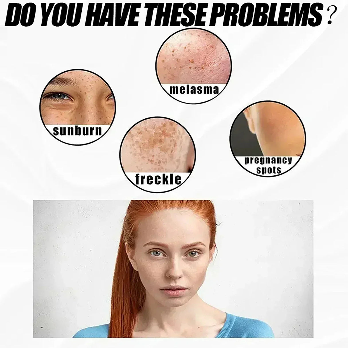 Whitening Freckle Cream Effectively reduces dark spots Brightens and revitalizes dull skin Hydrates and nourishes the skin