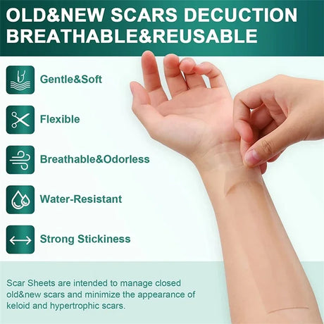 Silicone Scar Sheets - Reusable Scar Tape for Keloid, C-Section, Surgery, Burn, Acne - Waterproof, Hypoallergenic, Latex-Free