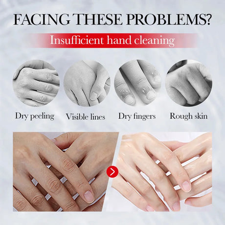 SADOER Kojic Acid Hand Cream Moisturizing Nourishing Brightening Hydrating Hand Creams Beauty Hands Skin Care Products