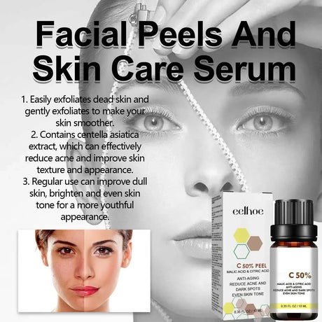 High Quality 50% Chemical Peel Acid Skin Superforce Pigmentation Lightening Melanin Acne Treatment Remove Scar