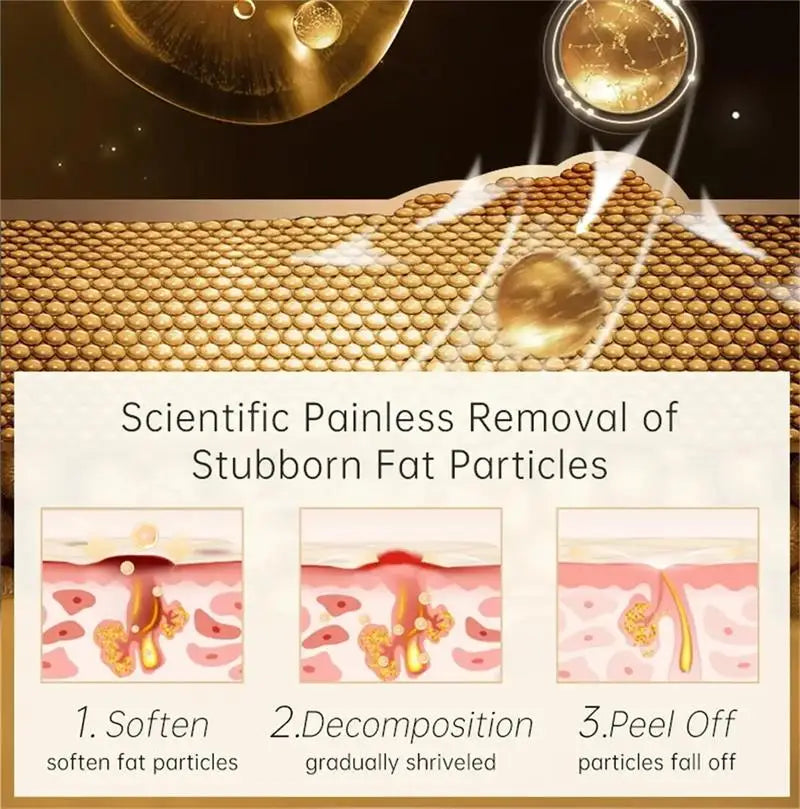 Fat Granules Remover Eye Cream Anti-Puffiness Anti Inflammatory Reduce Dark Circles Eyebags Fade Lines Moisturizing Eye Care