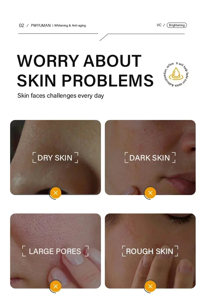 Dark Spots Remover Whitening Face Set Freckle Melanin Correcting Reduce Fine Lines Brighten Essence Korean Beauty Skin Care 