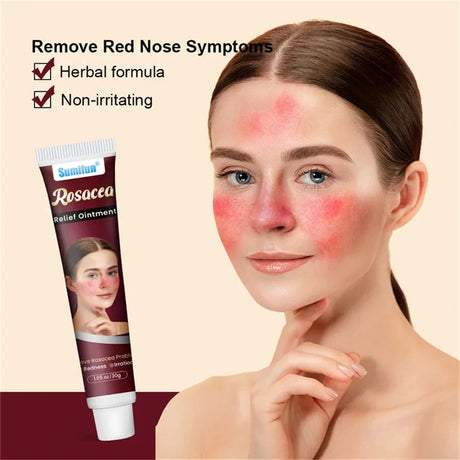 Repair Facial Redness Cream Instant Spider Vein Remove Sensitive Skin Sooth Anti Redness Rosacea Treat Lotion Korean Cosmetics