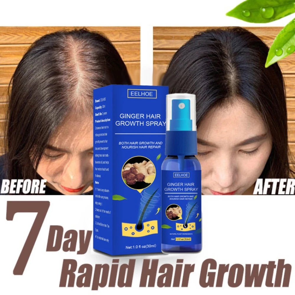 Ginger Hair Growth spray Anti Fall Loss Treatment Essence Oil for Men Women hair treatment