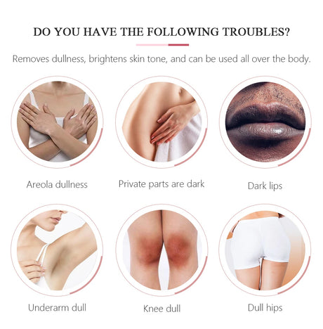Body Whitening Cream Private Parts Bleach Arm Knees Lip Dark Skin Brighten Melanin Intimate Area Pink Essence Moisturizing Care
