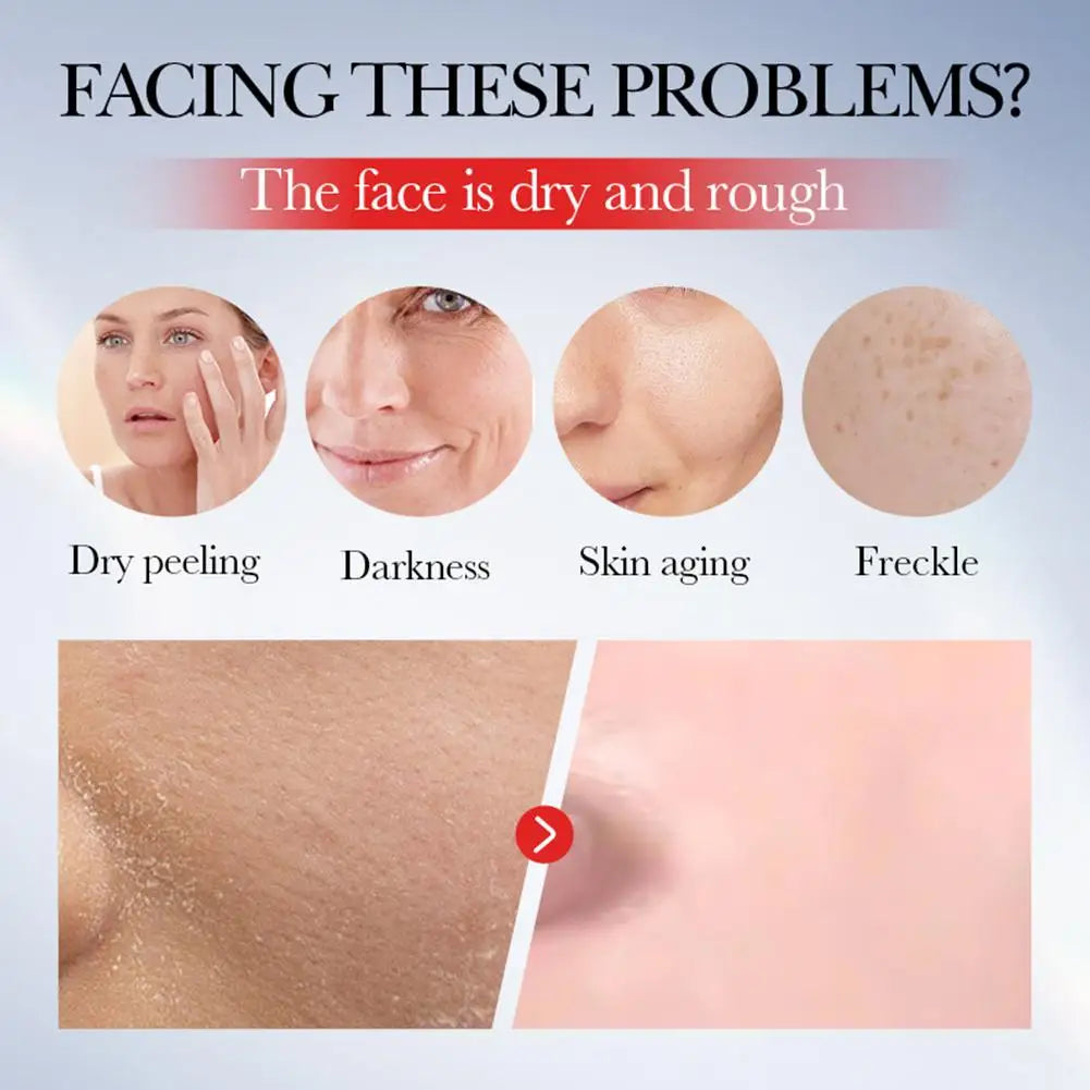 SADDER Kojic Acid Face Cream for Dark Spots Freckles Skin Care with Vitamin C, Whitening Treatment, Overnight Repair Moisturizer