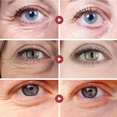 Collagen Eye Mask Essence Sakura Wrinkle Removing Eye Care Patches Fade Fine Line Anti Dark Circles Bag Anti-Puffiness Eye Care