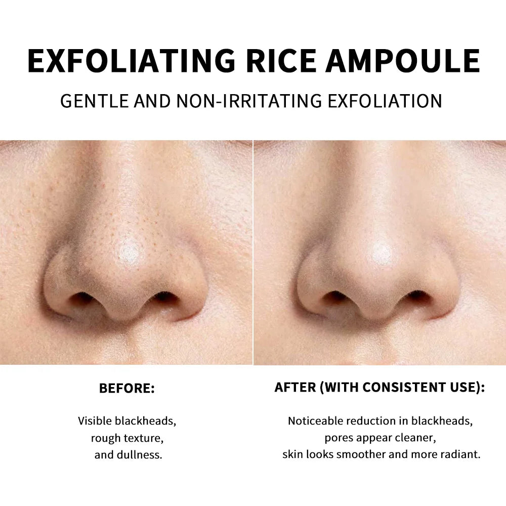 Rice Peeling Ampoule Soft Exfoliating Face and Body Scrub Dead Skin Cells Blackhead Remover for All Skin Types korean skin care
