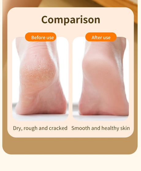 HOMEFISH Electric Foot Grinder Automatic Foot Callus Rubbing Pedicure Dead Skin Callus Remover for Foot Beauty Machine