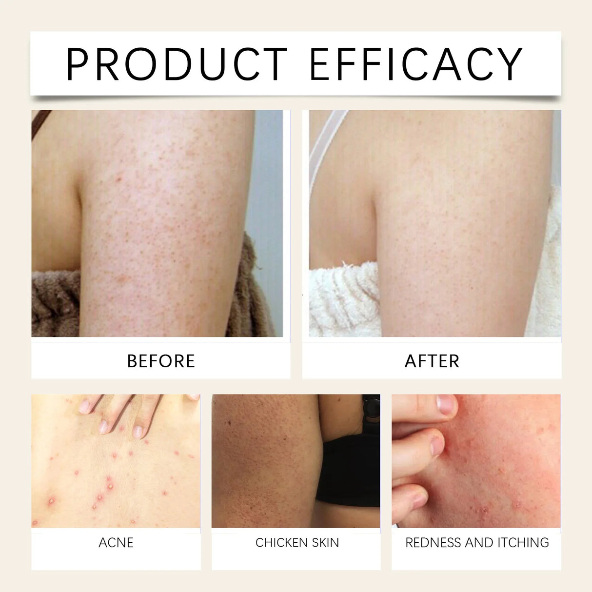 Ximonth Skin Soothing Spray Relieves Redness Itching Nourishes Moisturizes Soothes Skin Non Irritating Gentle Repair Skin Care