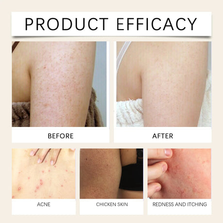 Ximonth Skin Soothing Spray Relieves Redness Itching Nourishes Moisturizes Soothes Skin Non Irritating Gentle Repair Skin Care