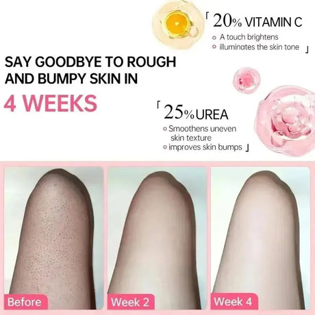 Keratosis Pilaris Repair Treatment Cream Exfoliating Removal Chicken Skin Cleaning Acne Spots Moisturizing Smooth Body Skin Care